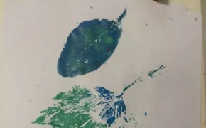 【血液科陪护】一片叶子落下来